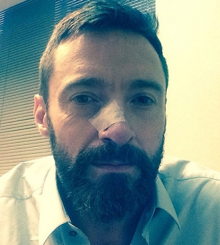 Хью Джекман проходит третий курс лечения рака кожи