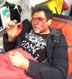 Андрея Джеджулу жестоко избили