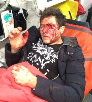 Андрея Джеджулу жестоко избили