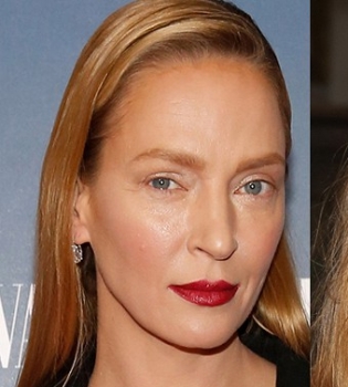 Экс-&quot;холостяк&quot;, пластический хирург Андрей Искорнев рассказал о пластике Умы Турман