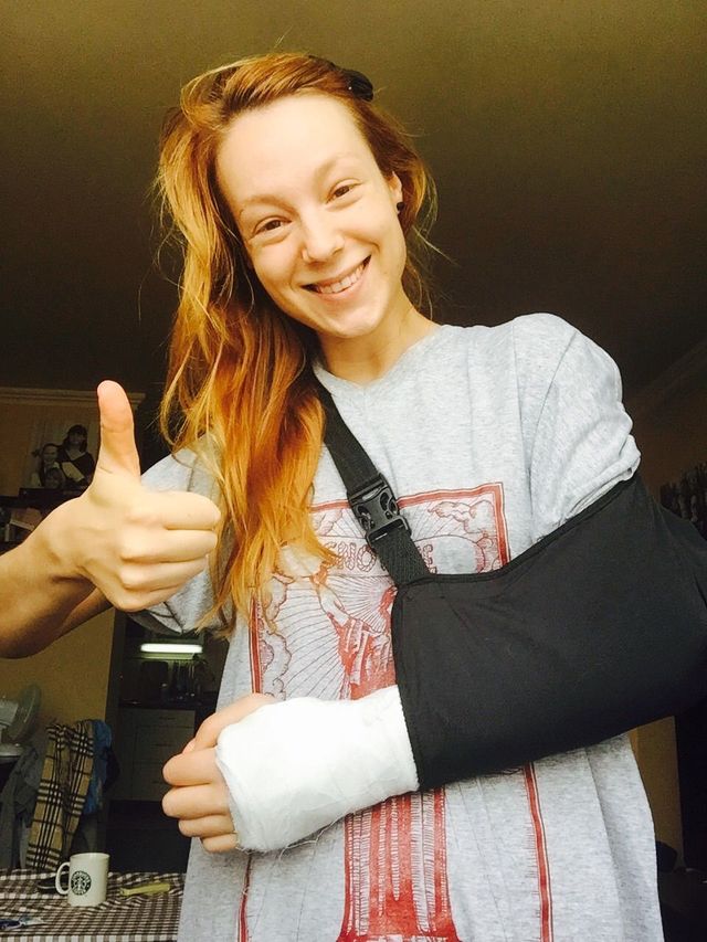 Светлана Тарабарова сломала левую руку
