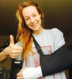 Светлана Тарабарова сломала левую руку