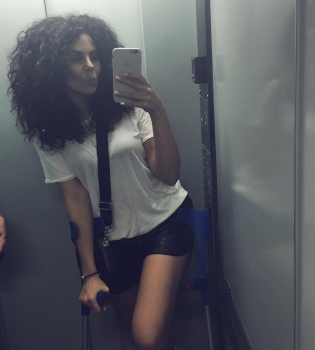 Настя Каменских продолжает заниматься спортом с серьезной травмой ноги