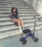 Настя Каменских поделилась подробностями своего отдыха с переломанной ногой