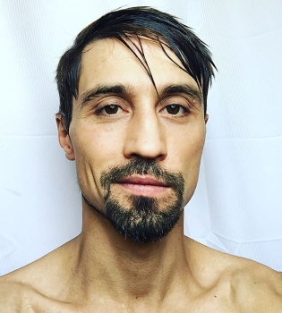 Дима Билан сильно похудел из-за болезни