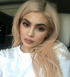 Кайли Дженнер впервые откровенно рассказала о пластических операциях