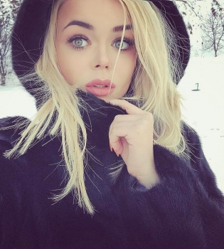 Пластические хирурги прокомментировали кардинальные изменения во внешности Алины Гросу