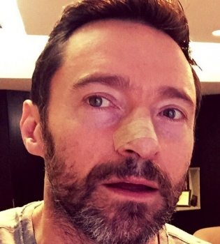 Хью Джекман уже в шестой раз борется с раком