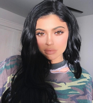 Кайли Дженнер о пластике