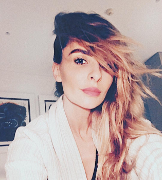 Катя Варнава уменьшила губы