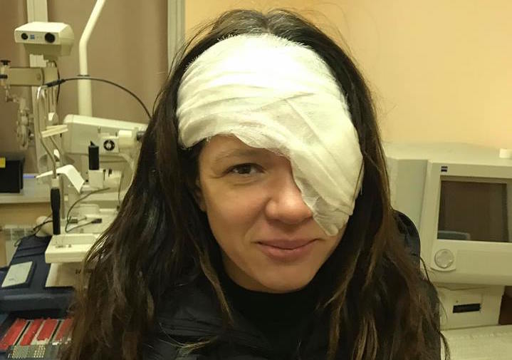 Руслана перенесла серьезную травму на глазу и вышла на сцену с открытой раной