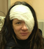 Руслана перенесла серьезную травму на глазу и вышла на сцену с открытой раной