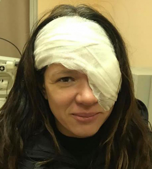 Руслана перенесла серьезную травму на глазу и вышла на сцену с открытой раной