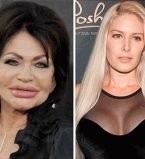 пластическая хирургия