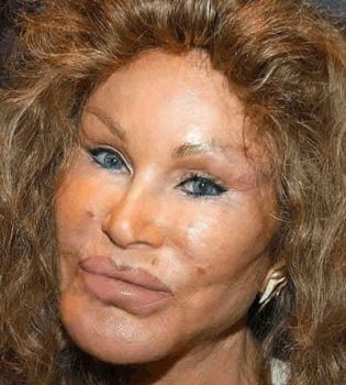 Джоселин Вильденштейн