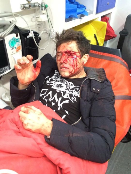 Андрея Джеджулу жестоко избили в Киеве: фото и комментарии пострадавшего