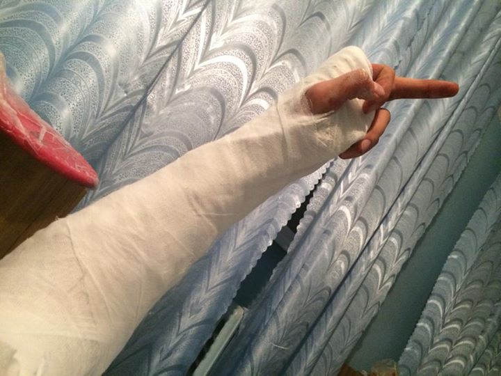 Андрея Джеджулу жестоко избили в Киеве: фото и комментарии пострадавшего