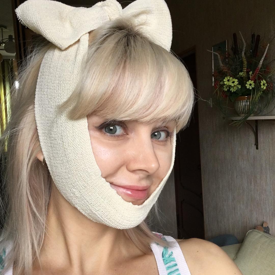 Певица Натали травмировала лицо пластическими операциями 