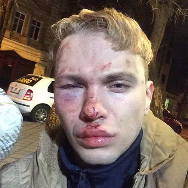 Участника "Голос країни" и подопечного Ивана Дорна жестоко избили в Одессе