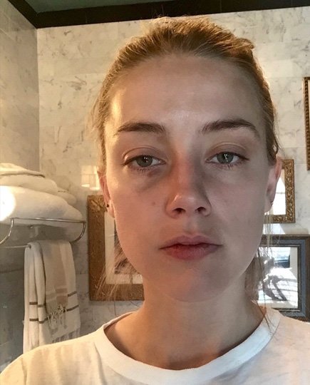 Эмбер Херд обнародовала снимки, сделанные после того, как ее избил Джонни Депп