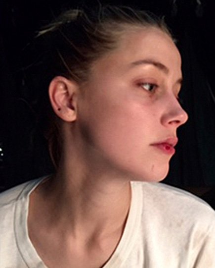 Подруга Эмбер Херд выступила в защиту актрисы: &quot;Я видела ее синяки&quot;