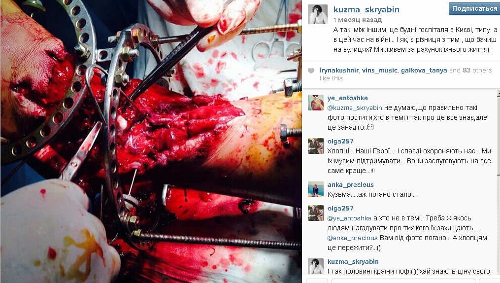 За месяц до смерти Кузьма Скрябин встретился с военными из зоны АТО